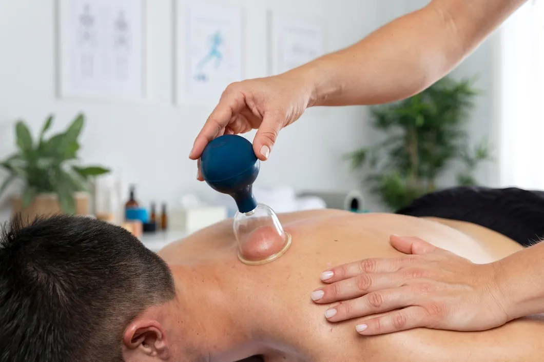 physiotherapist-performing-cupping-session